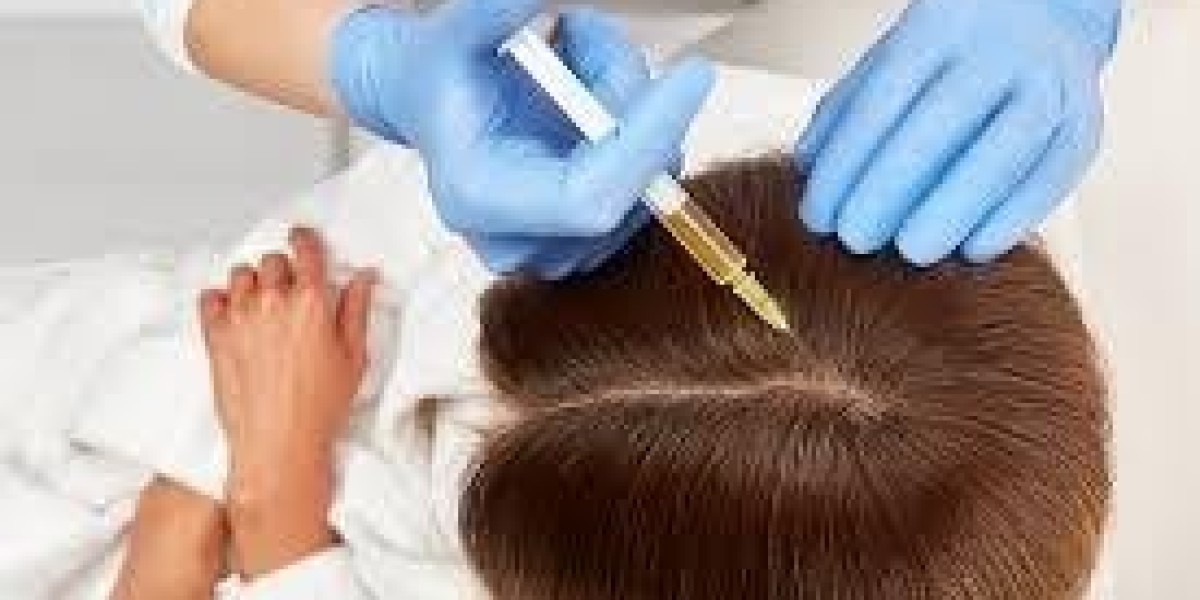 How Does PRP Work on Weak Hair Roots?