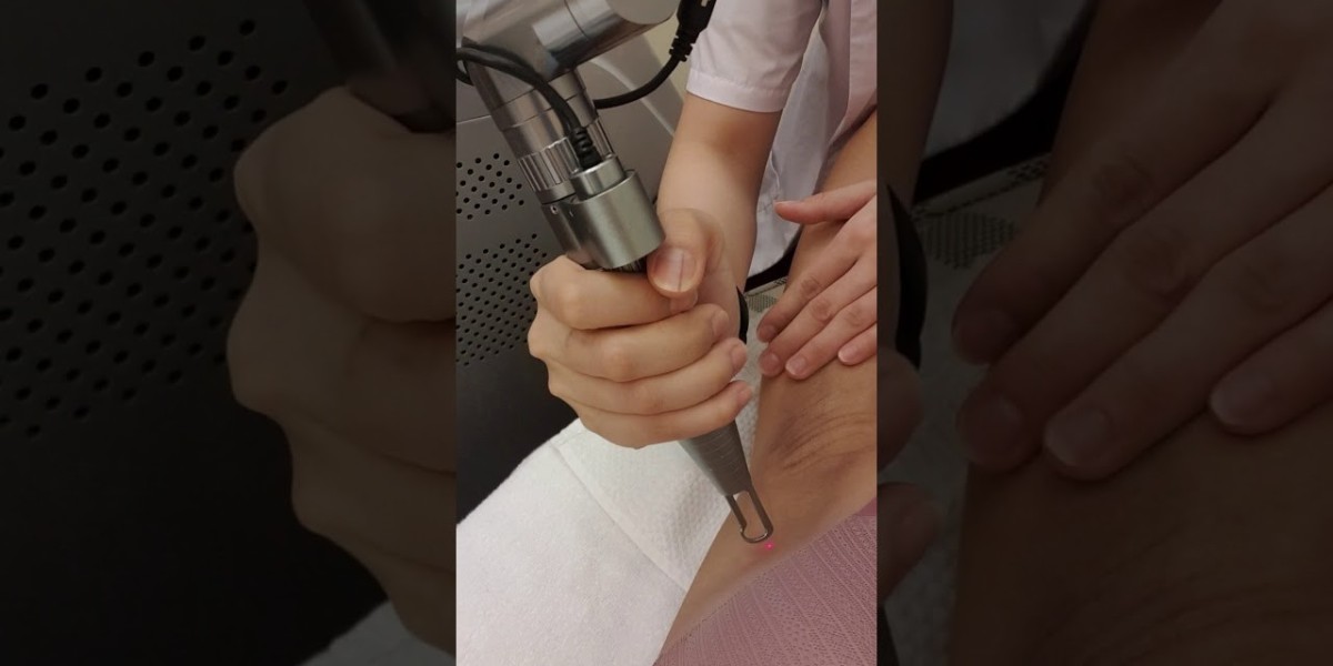 Laser Whitening for Underarms: Tips & Insights