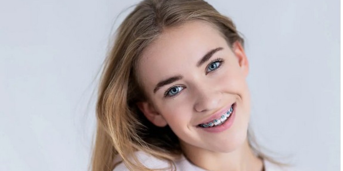 How Orthodontic Treatment Improves Your Smile  ?