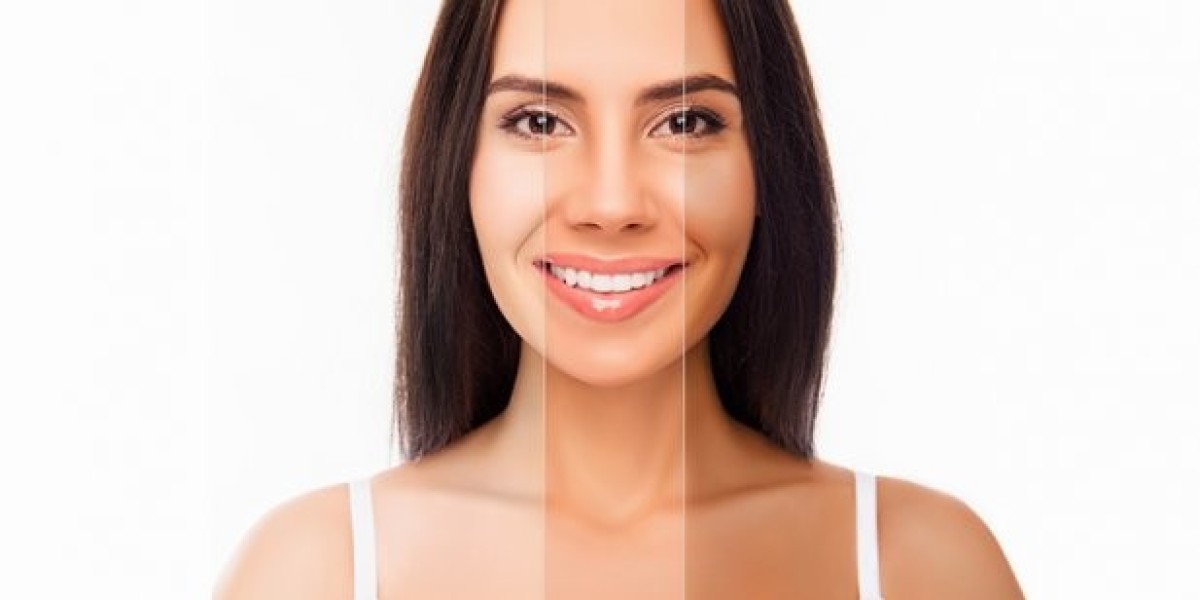 Defeating the Desert Glow: A Strategic Guide to Hyperpigmentation and Melasma in the Najd