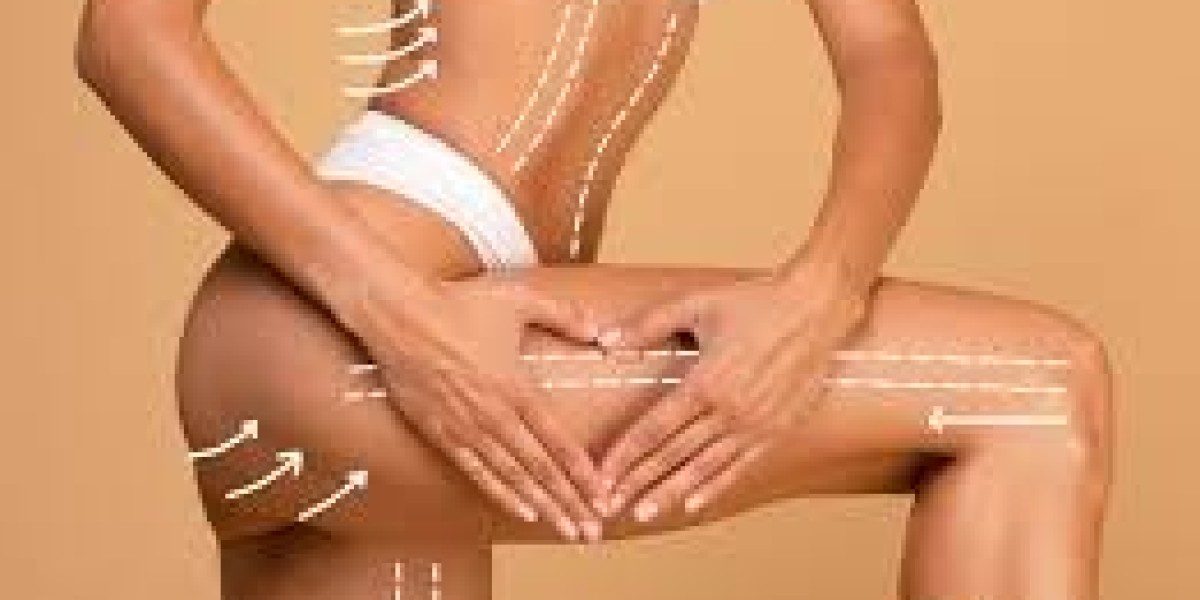 Thigh Lift in Dubai: Long Lasting Body Contouring Effects