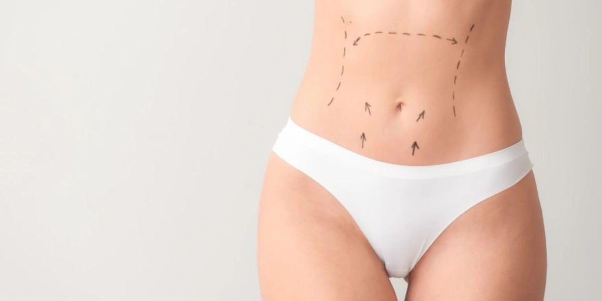 Liposuction Aftercare Tips for Better Results