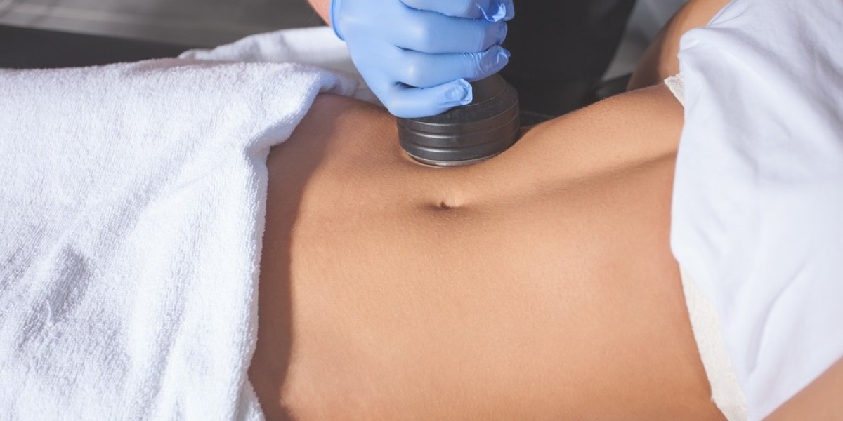 Body Contouring in Islamabad: Expert Tips for Best Results