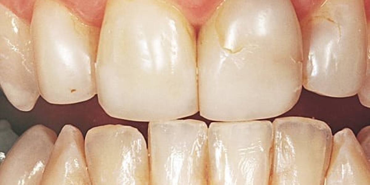 Orthodontics Sunbury: Your Complete Guide to a Straighter, Healthier Smile