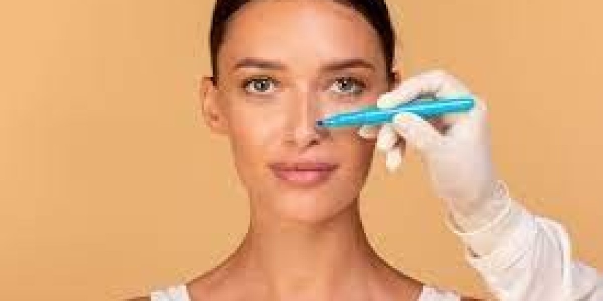 Rhinoplasty for Bulbous Tips: Refine and Reshape Effortlessly