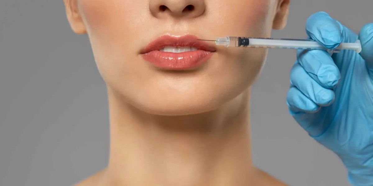 Lip Filler Injections How to Avoid Overfilled Results?