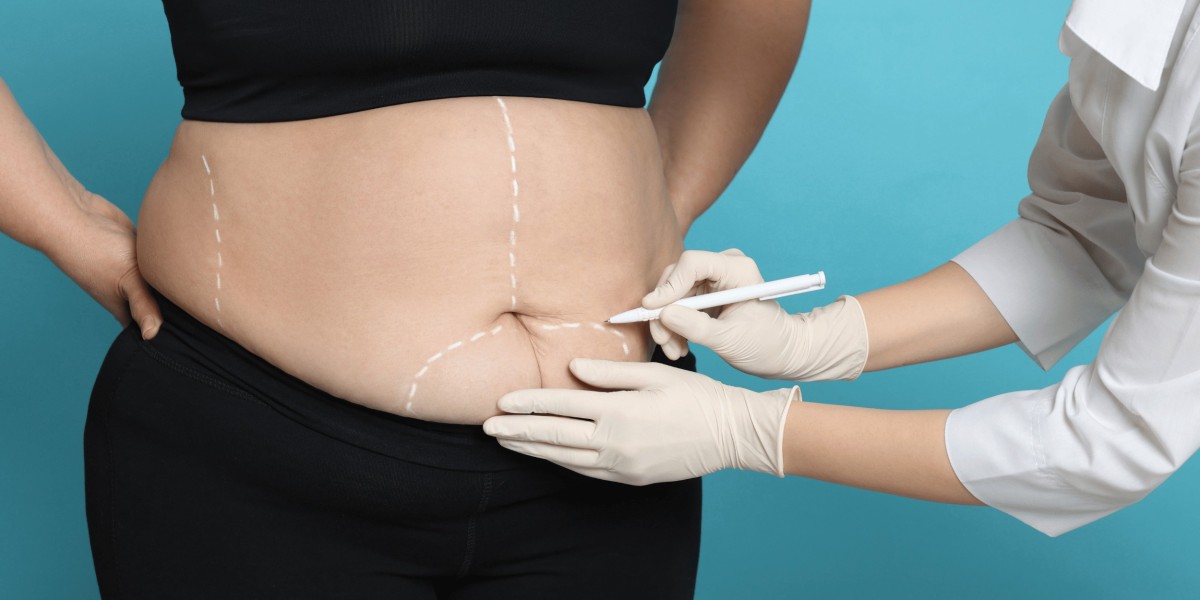 Fat Melting Injection in Dubai for Targeted Fat Loss