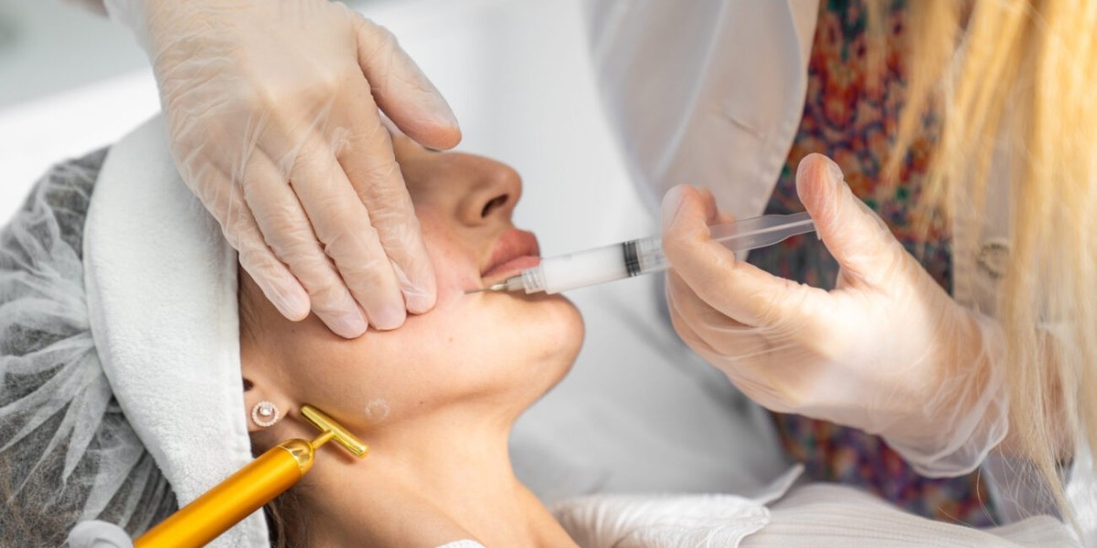 Sculptra Fillers in Dubai: What to Expect During the Procedure