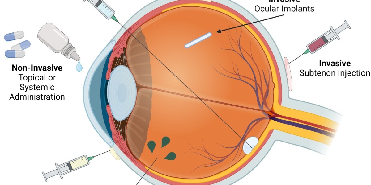 Smart Solutions for Eye Diseases: Emerging Trends in Ocular Drug Delivery