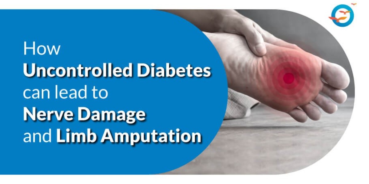 How Uncontrolled Diabetes Can Lead to Nerve Damage and Limb Amputation?