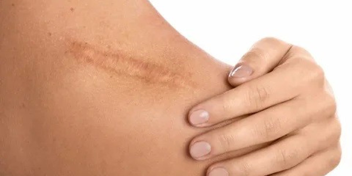 Reduce Post-Op Scars with Professional Treatment Islamabad