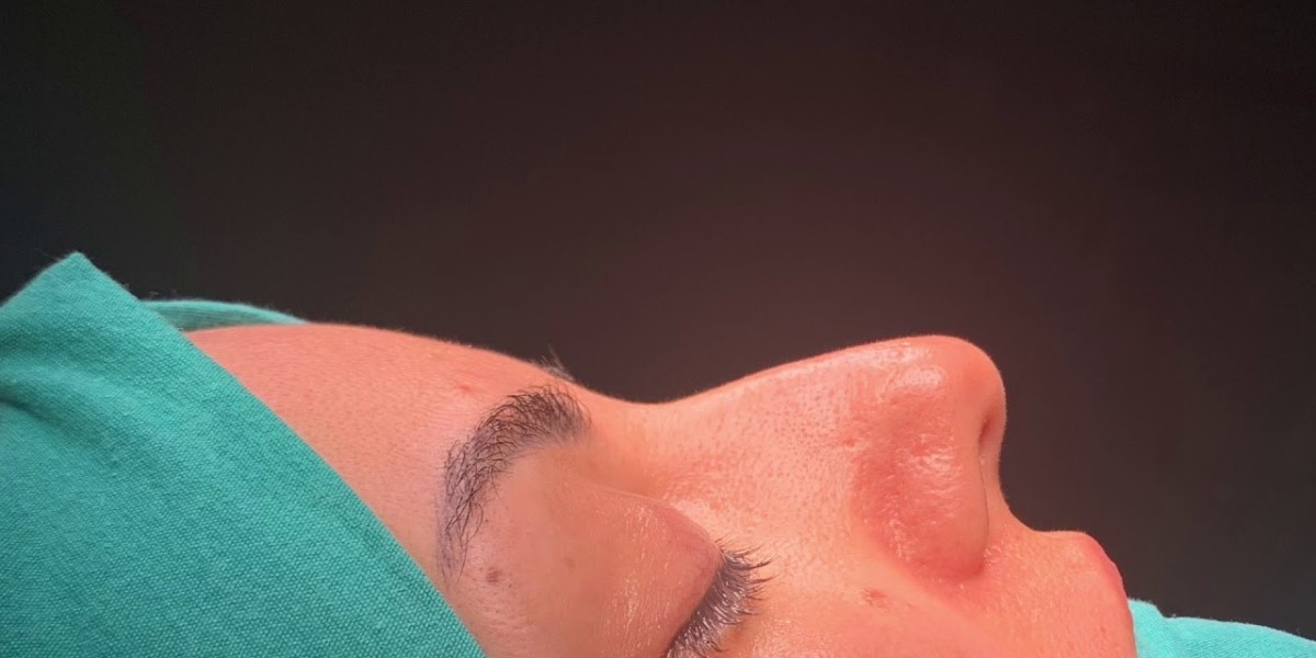 Silicone Nose Surgery in Riyadh: Achieve Your Ideal Profile