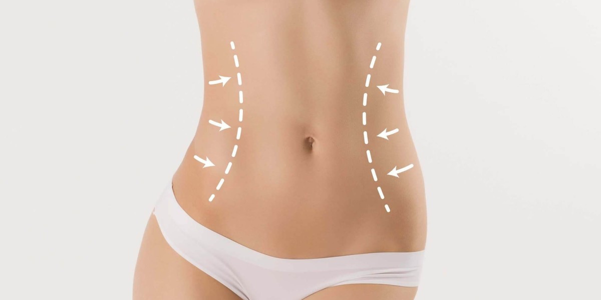 Body Contouring in Islamabad for Thighs
