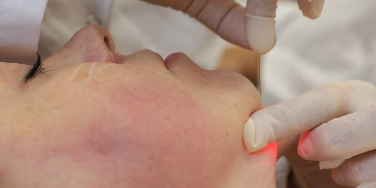 Endolift Treatment in Dubai: Non-Surgical Skin Tightening Guide
