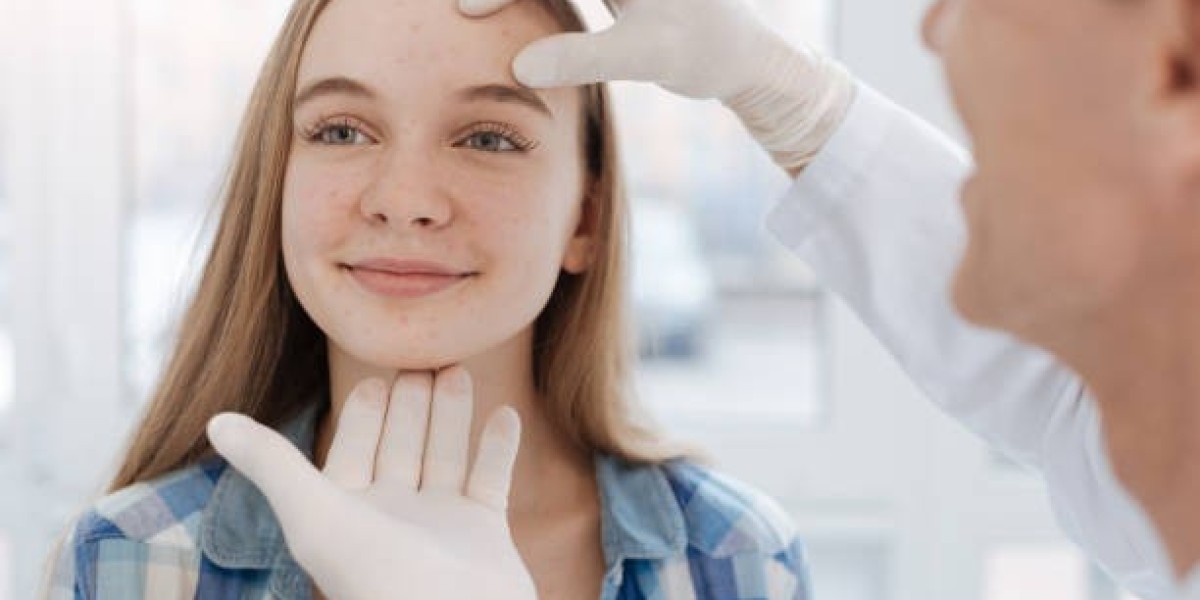 The Best Dermatologist For Acne Treatment In Dubai Explains Hairline Acne