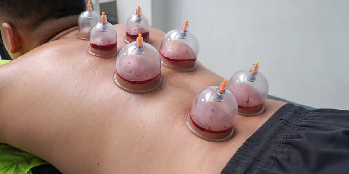 How Cupping Therapy in Dubai Supports Respiratory Health