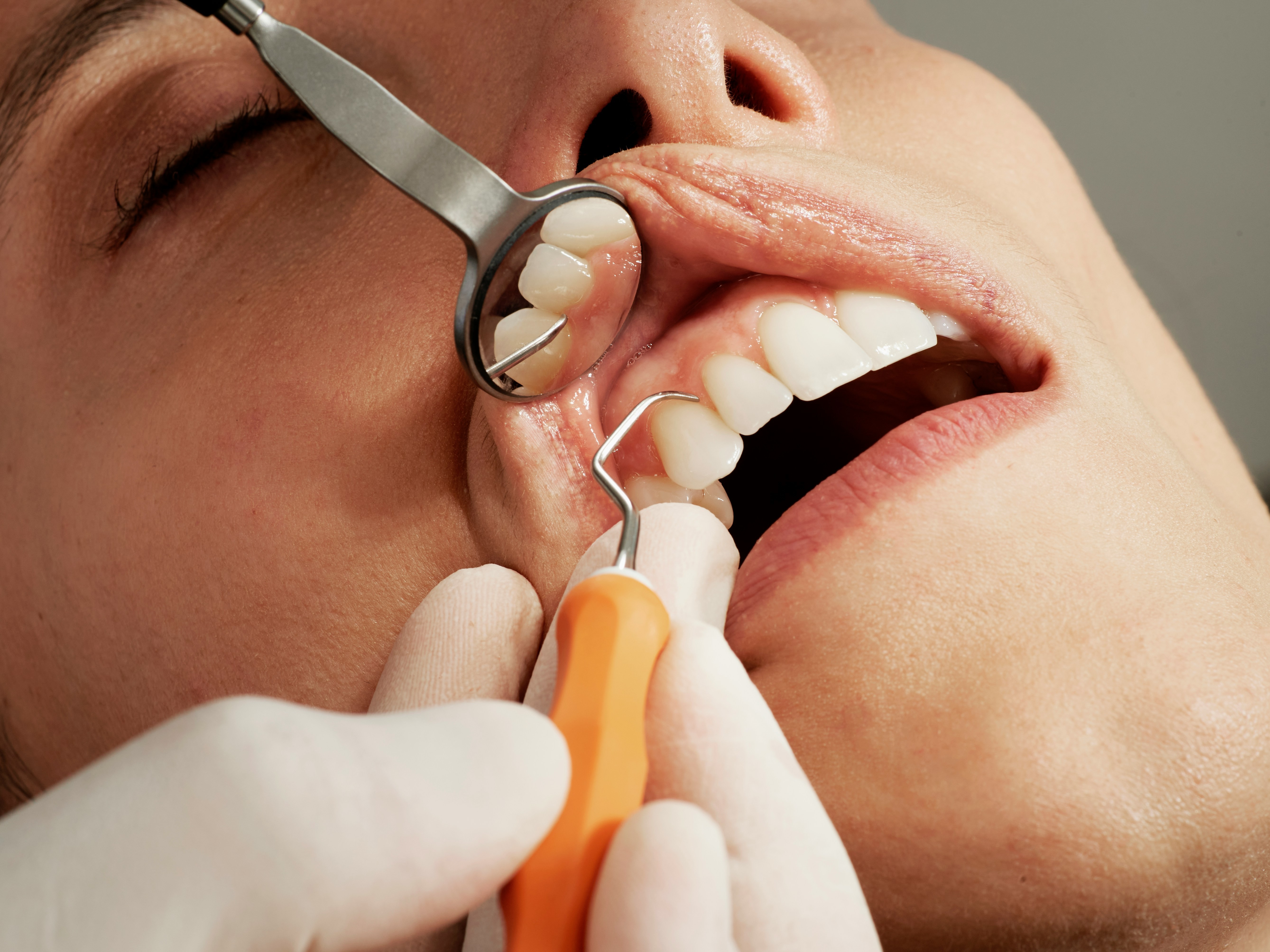 warnerlakesdental02