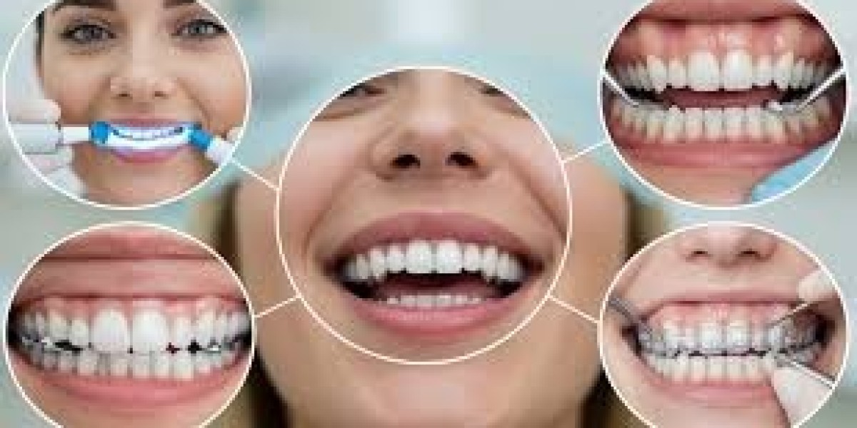 My Teeth Braces Experience at Smileon Dental – A Real Smile Transformation Journey