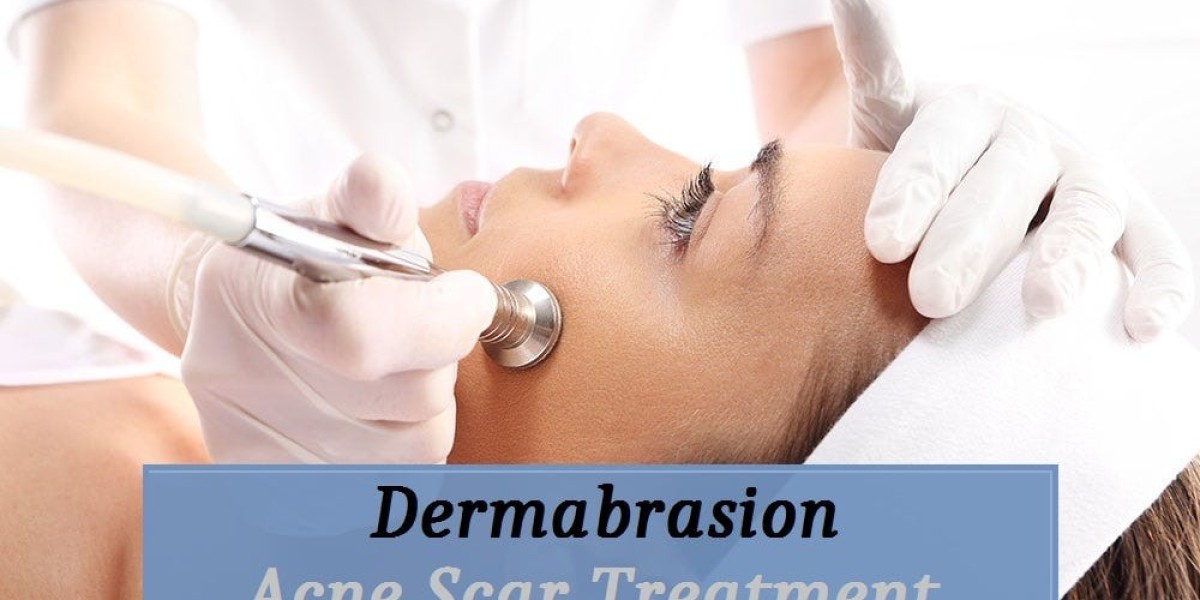 Restoring Skin Smoothness: How Dermabrasion Targets Uneven Texture