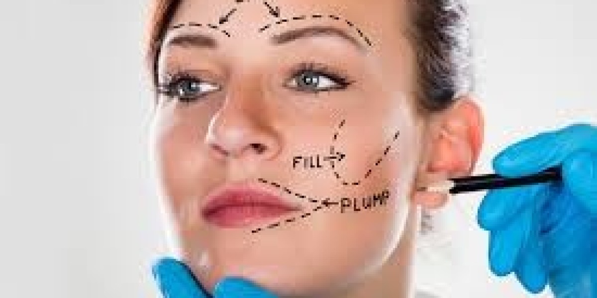 Can a Facelift Remove Deep Wrinkles and Sagging Skin