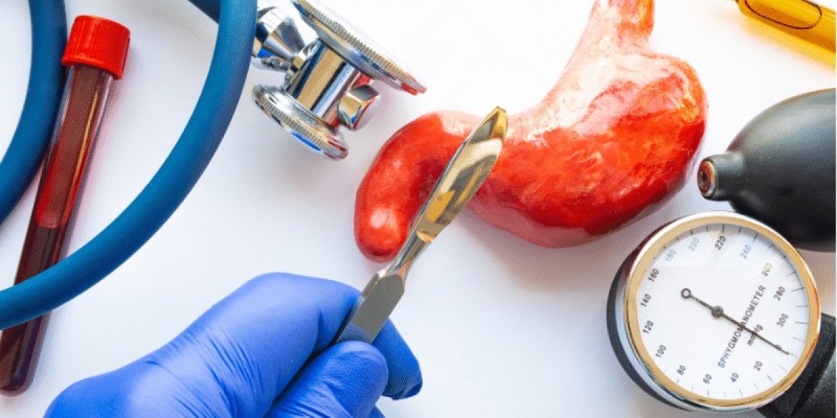 What to Expect Before and After Bariatric Surgery