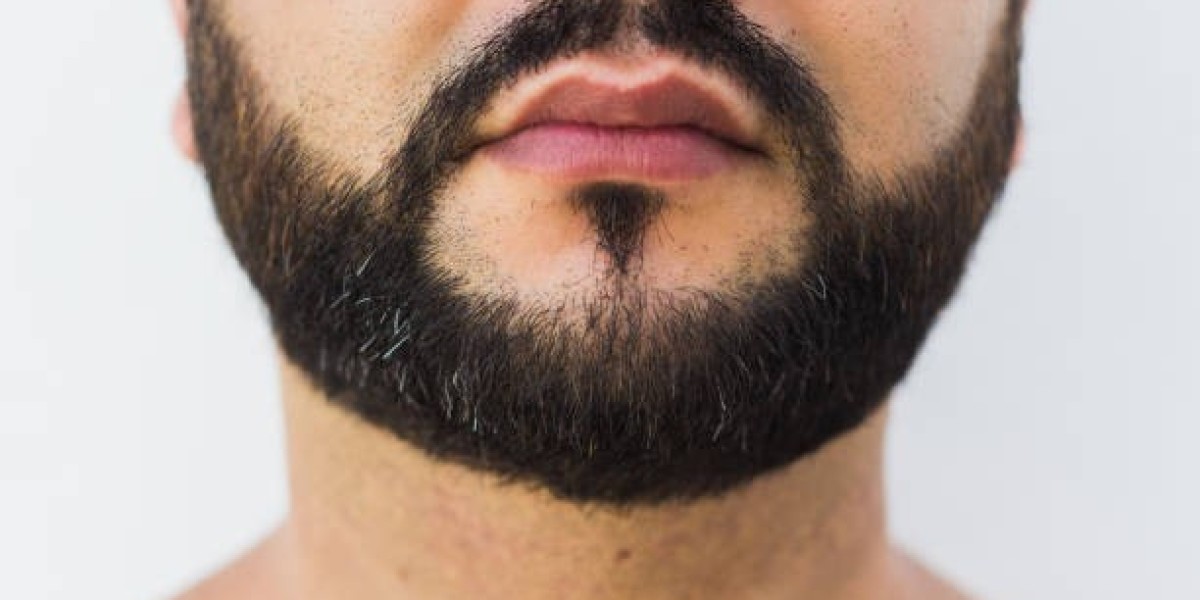 The Modern Solution for a Perfect Beard transplant: