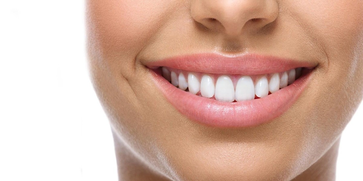 Where to get dental implants in Benalmadena
