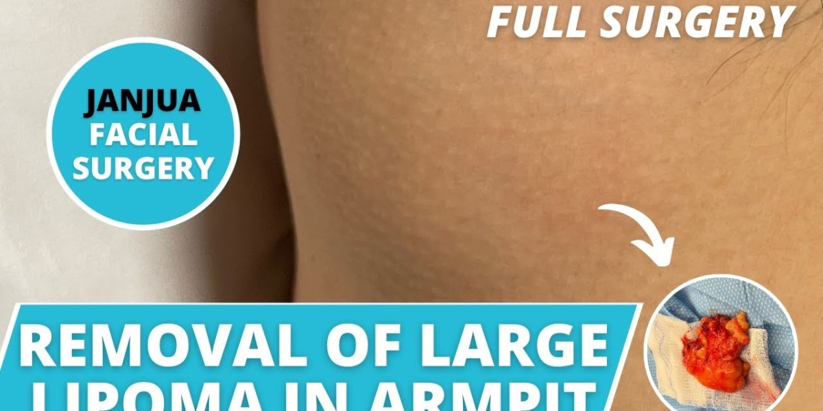 The Psychological Impact of Visible Lipomas and the Relief of Removal