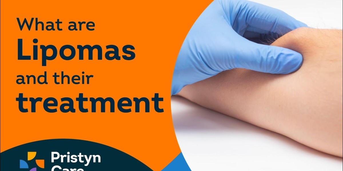 Understanding Lipomas: Symptoms, Causes, and Treatments in Saudi Arabia