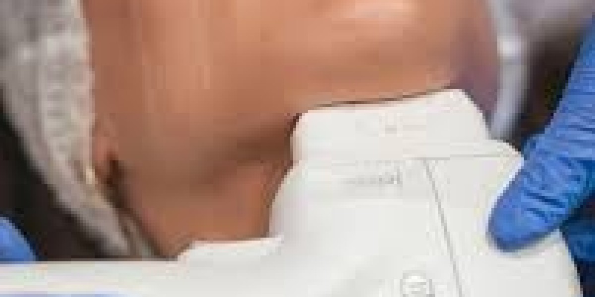 Ultertherapy Treatment in Dubai: Best Anti-Aging Option Guide