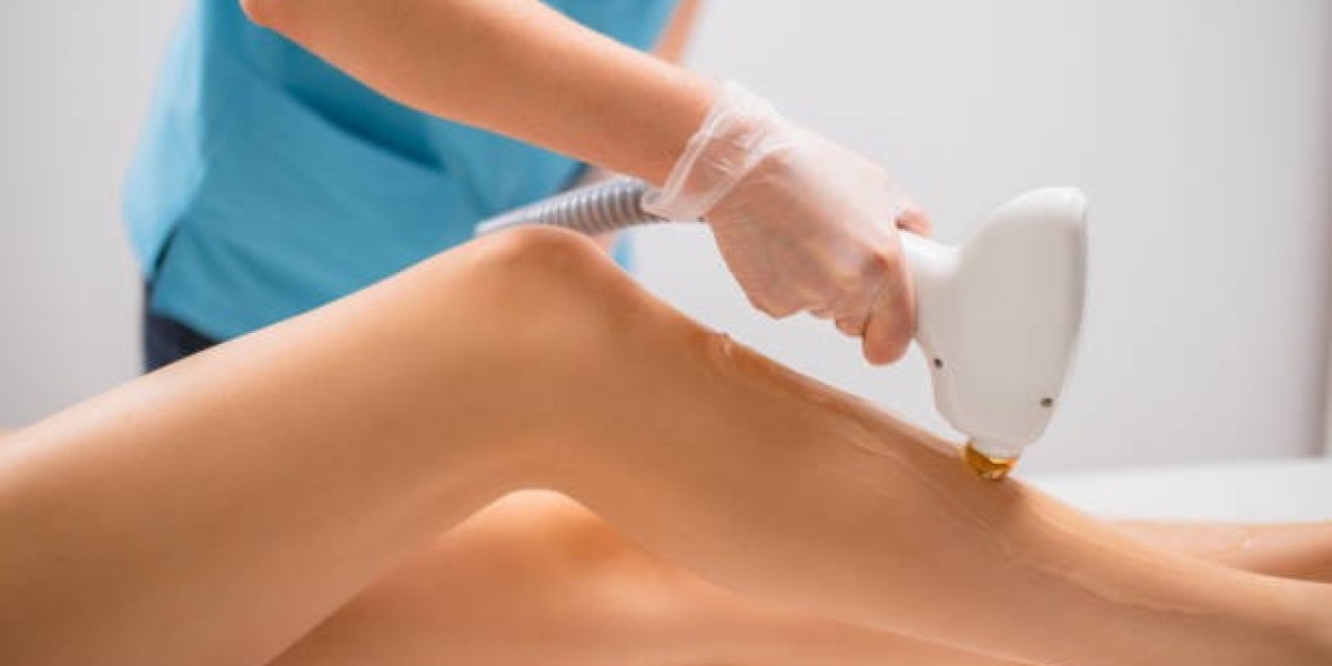 Laser Hair Removal Innovations for Future Smoothness