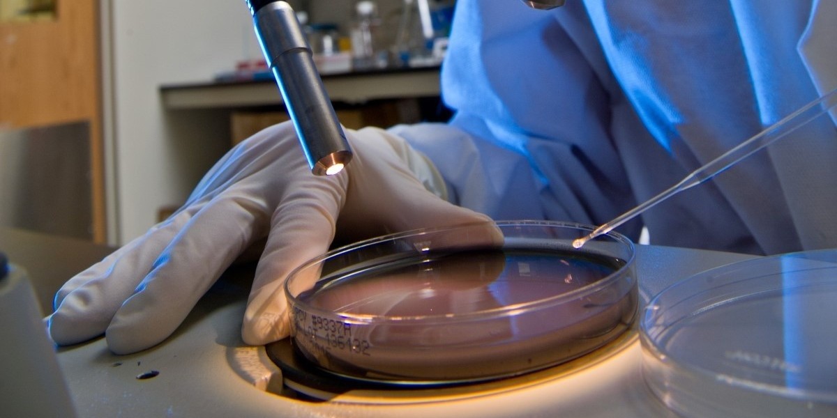 Legionella Testing Market Set to Reach US$ 742.5 Mn by 2034 Amid Rising Pneumonia Cases