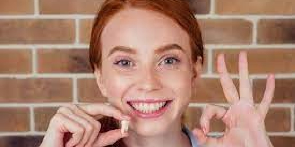How Composite Veneers Help Correct Minor Imperfections in Brisbane