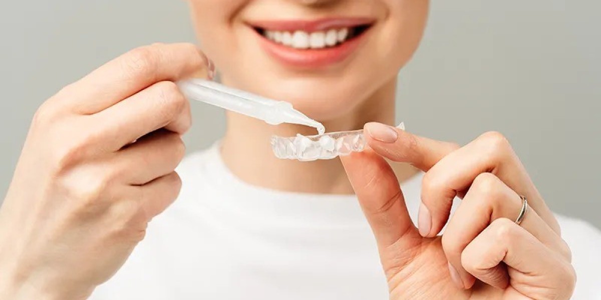 How Many Shades Whiter Can Teeth Get?