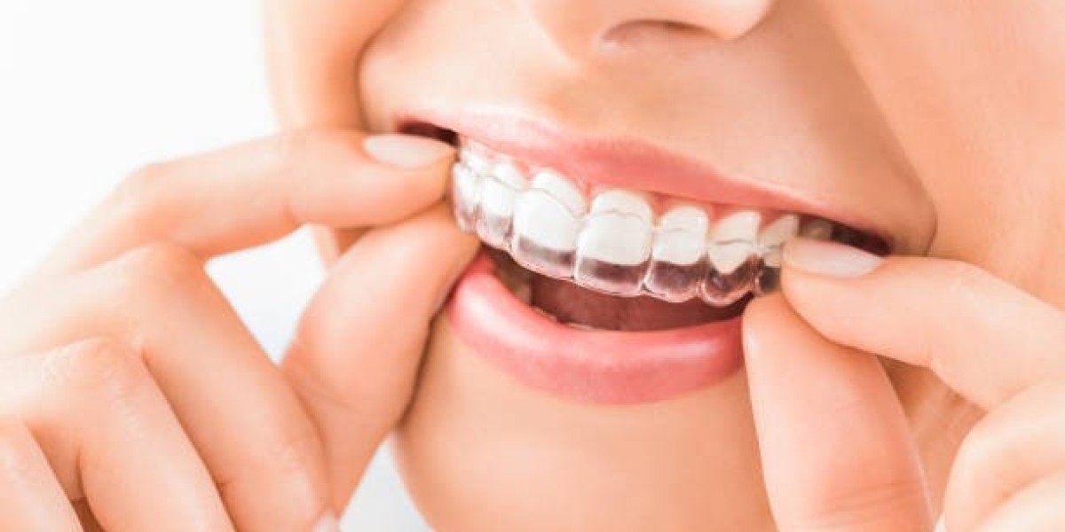 Long-Term Smile Security with Teeth Retainers in Islamabad