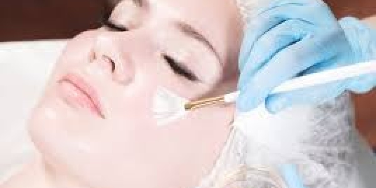 Chemical Peels in Dubai for Oily Skin Control