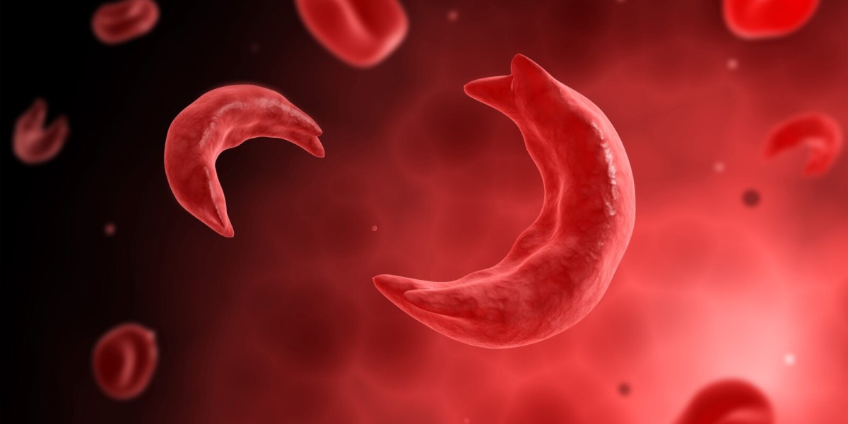 Sickle Cell Disease Treatment Market Outlook: Opportunities in North America and Asia Pacific