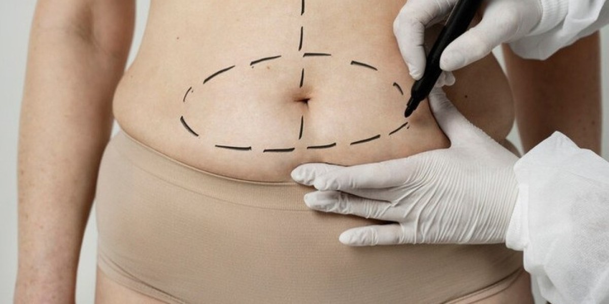 Lipomatic Treatment in Riyadh: The Future of Body Contouring