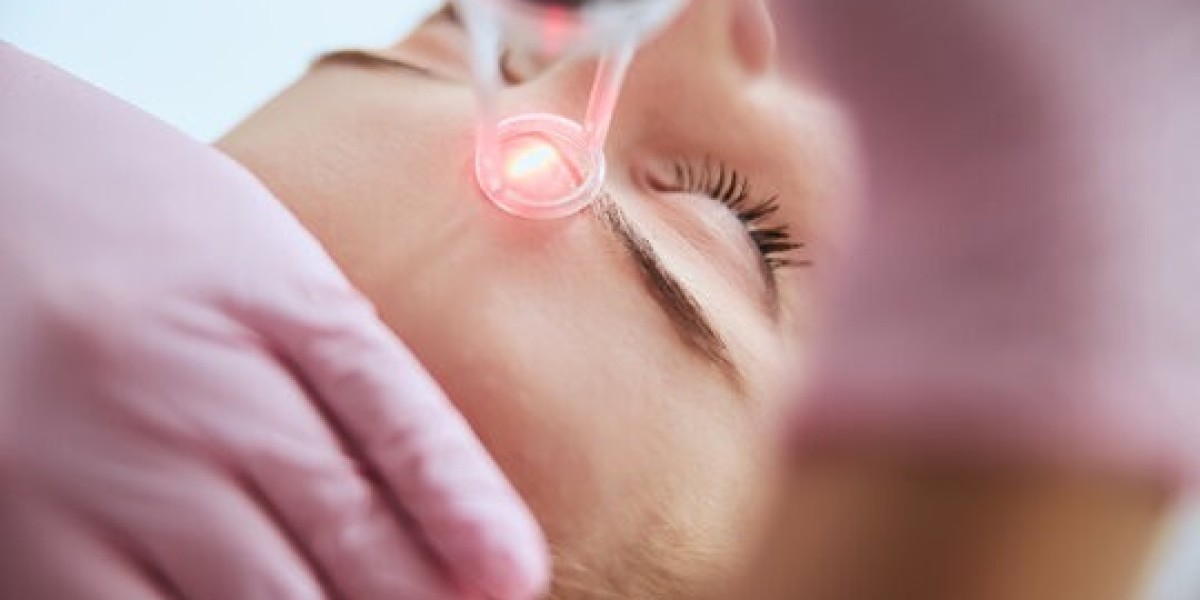 PICO Laser Treatment in Islamabad vs Traditional Laser: Which is Better?