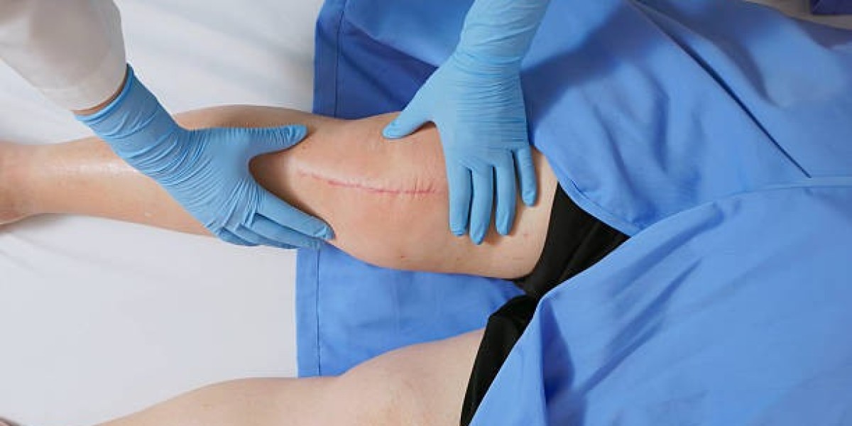 Top-Rated Post-Surgical Scar Treatment in Dubai Services