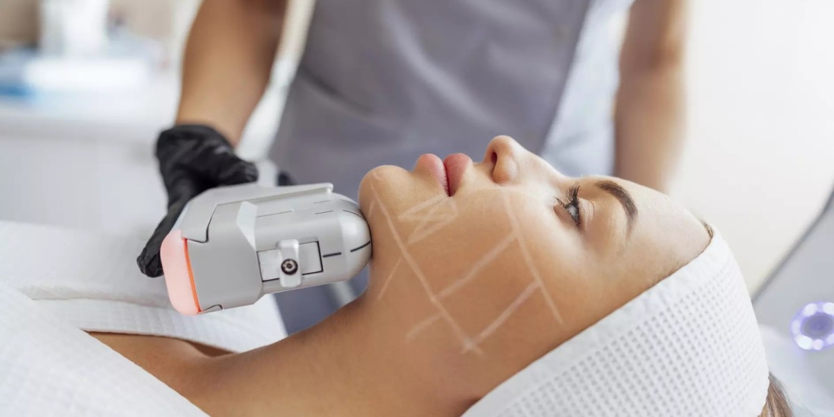 HIFU vs Surgical Facelift: Which One Is Better?