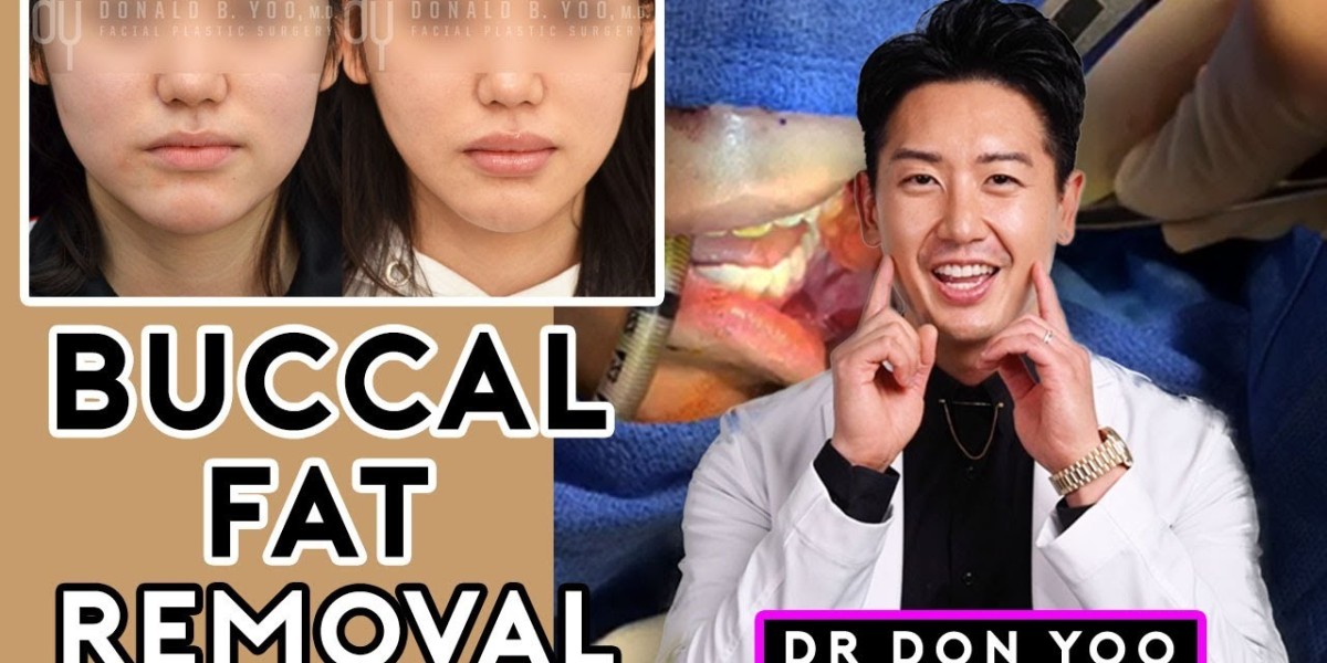 The Rise of the V-Shape Face: Buccal Fat Removal in Riyadh