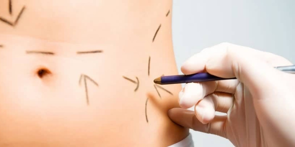 Achieving a Flat Stomach: Is a Mini Tummy Tuck Right for You?