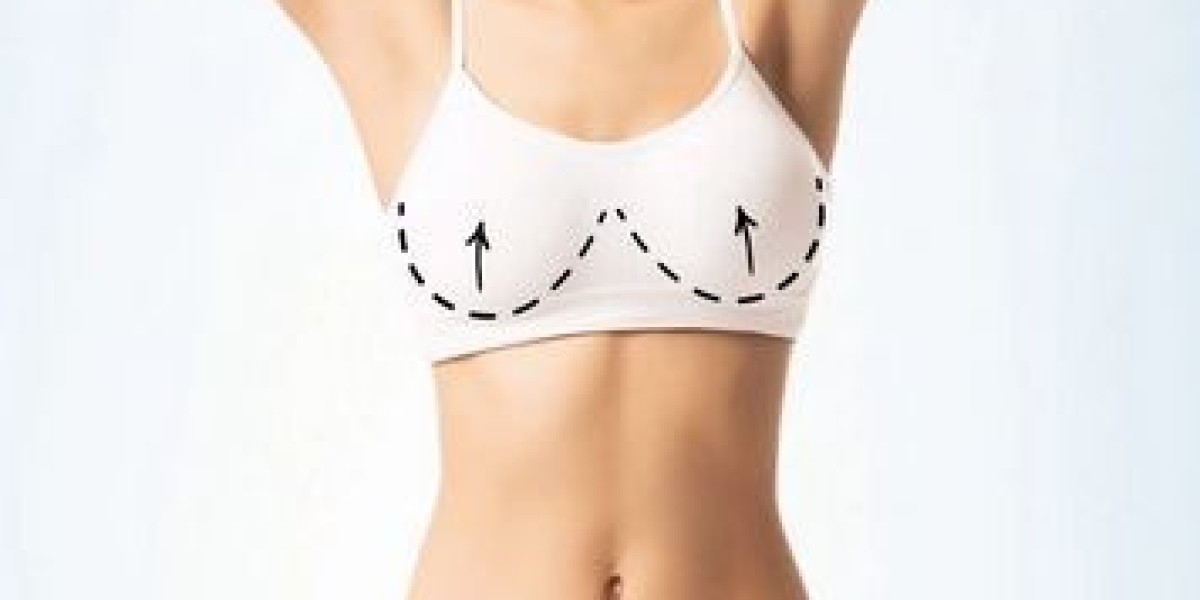 Breast Augmentation for Post-Pregnancy Body Restoration