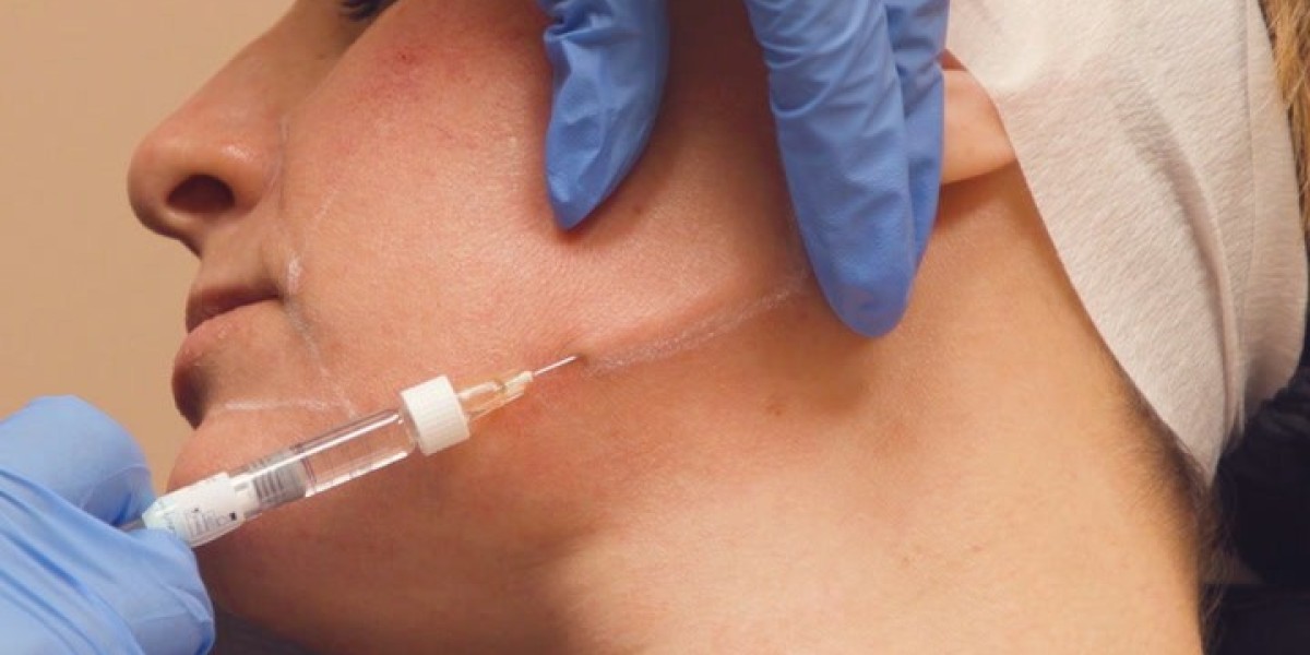 Jawline Filler Injections in Dubai Natural Look