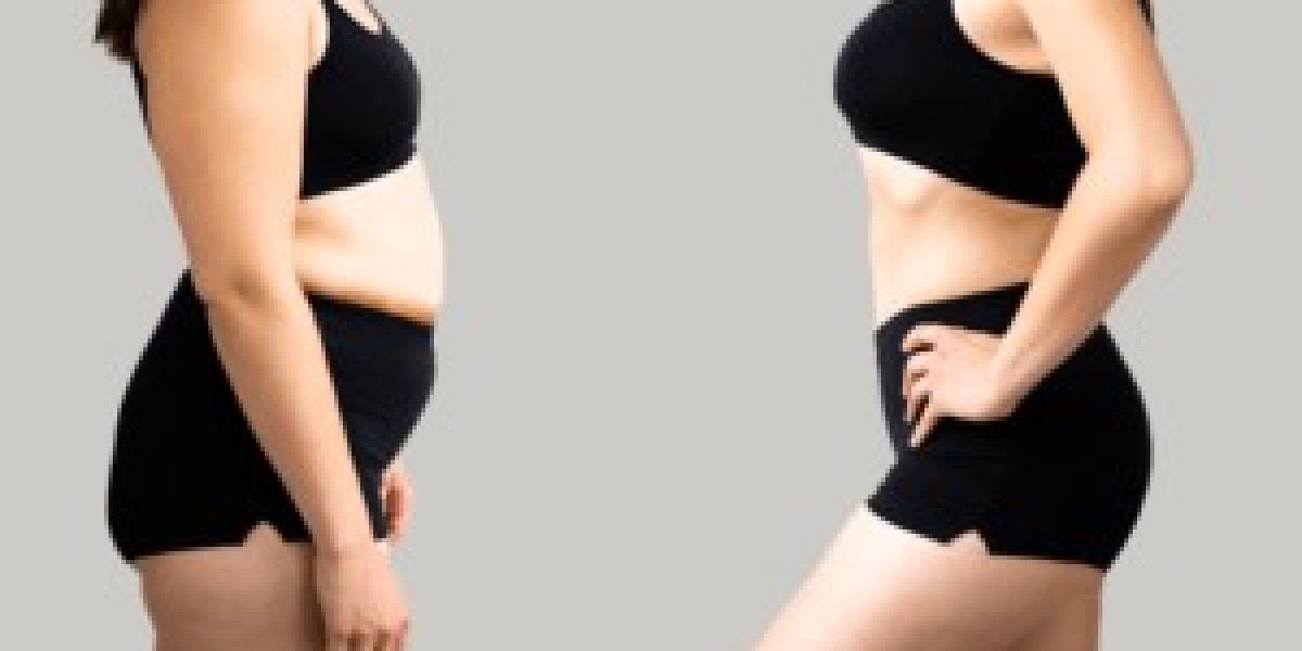 Wegovy Injection in Dubai UAE Availability Guide