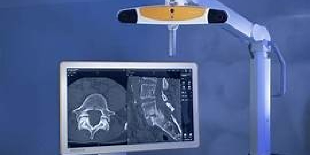 Improving Surgical Outcomes with Image-Guided Surgery Devices