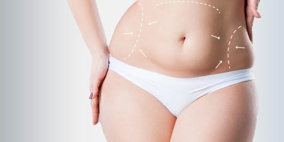 Benefits of Choosing the Best Mini Tummy Tuck Dubai Procedure