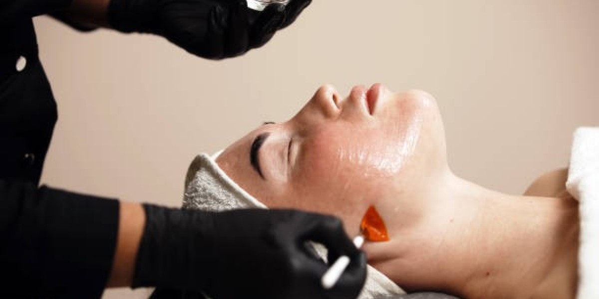 Latest Trends in Chemical Peels in Islamabad for 2026