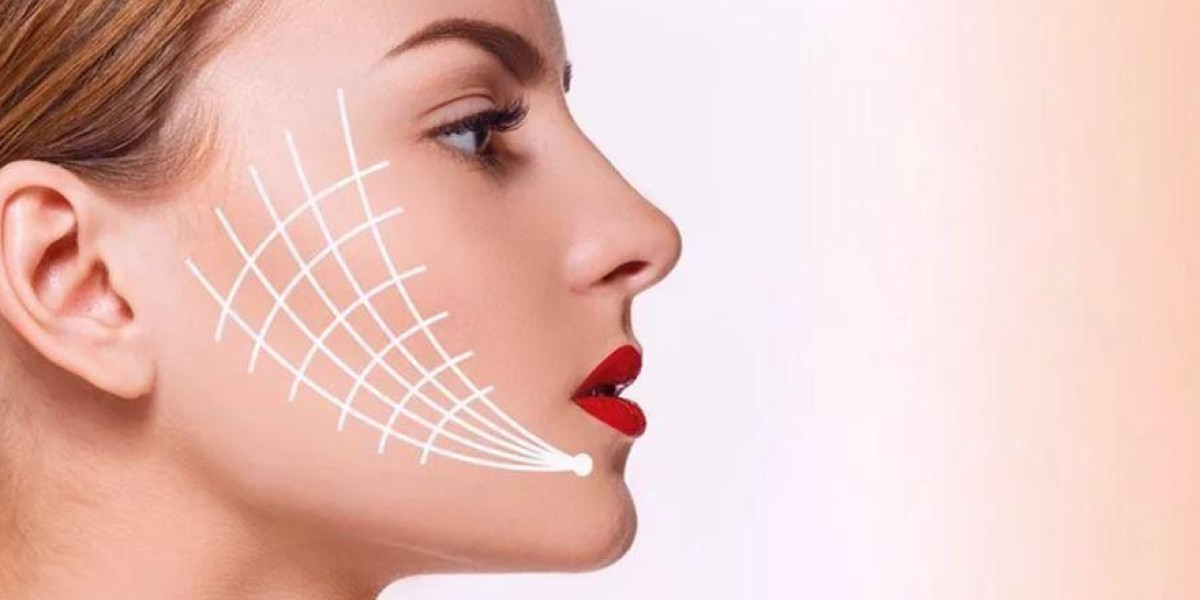 Why Thread Lift in Islamabad Is Trending on Social Media